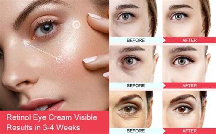 3 Illuminating Eye Creams To Make You Look Awake