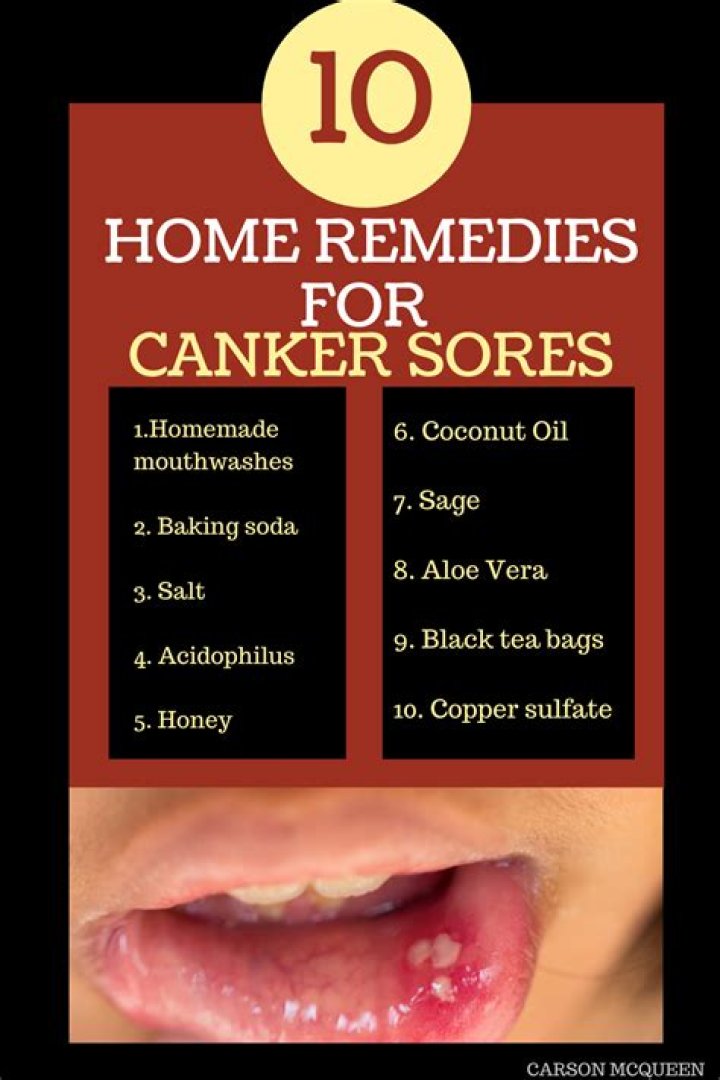 7 home remedies for canker sores you may not have tried