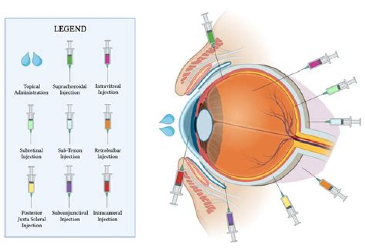 Definitions of Opthalmic - OneLook