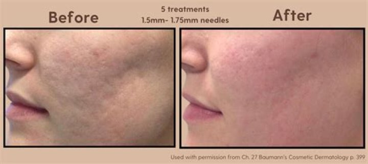 How beneficial is a 30 minute facial? We investigate