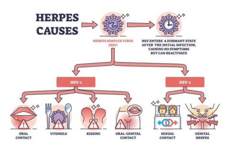 How Can Genital Herpes Spread Non Sexually