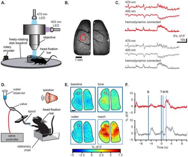 KU Medical Center researcher published in NEJM study showing large-core strokes can be treated with vacuum to retrieve clot