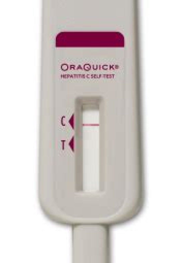 Oraquick False Negative Stories - Statcare