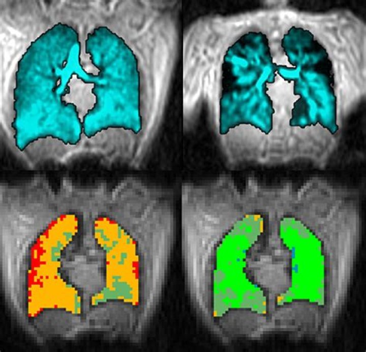 Quantitative Pulmonary Imaging Cores