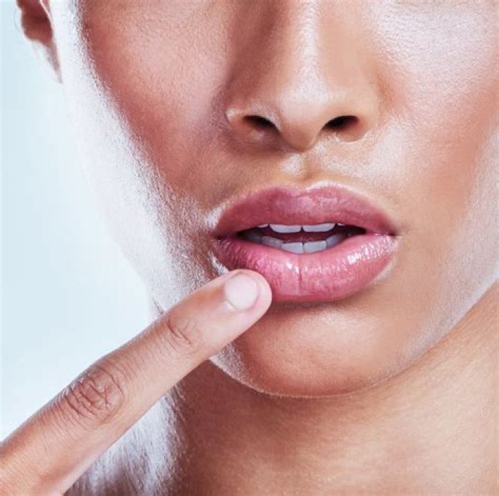 Topilase Filler Cream News Explained