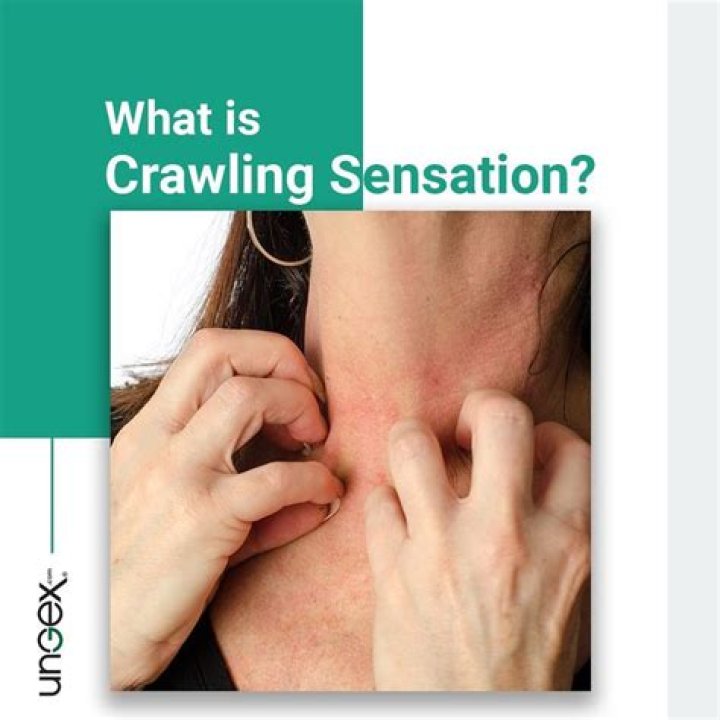 Understanding the Crawling Sensation in Scalp