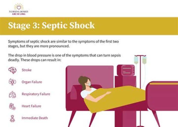 What Is Septic Shock? Mario Dumaual's Death Explained