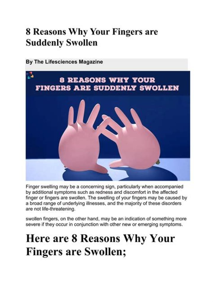 Why Your Fingers are Suddenly Swollen